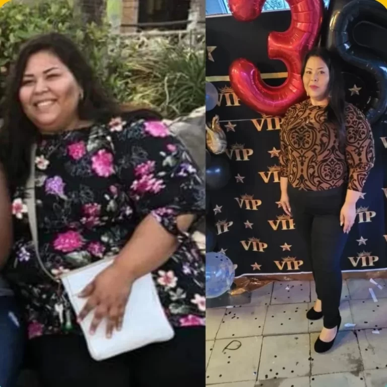 Bariatric Before and After_20