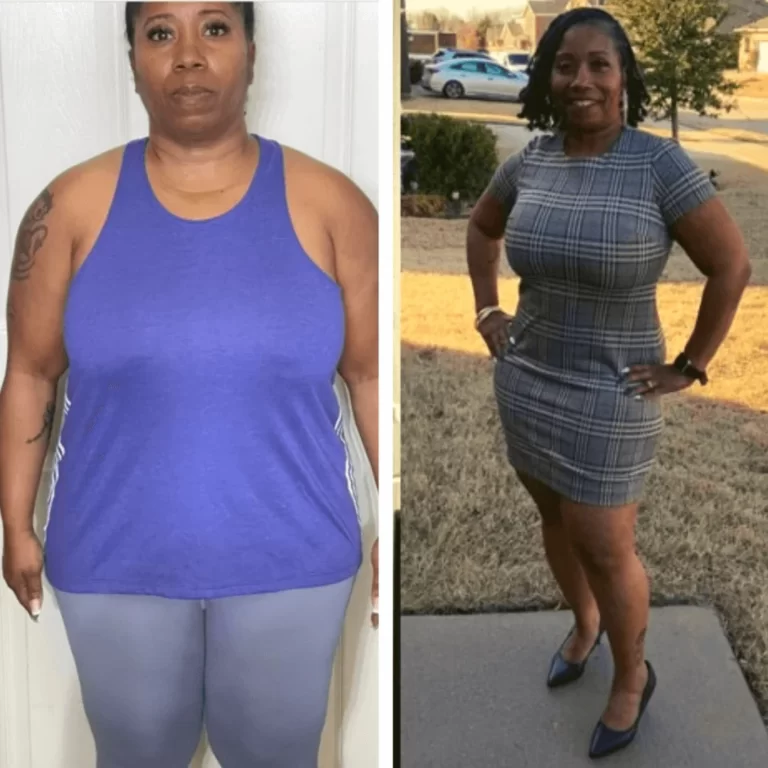 Bariatric Before and After_Shawn (2)